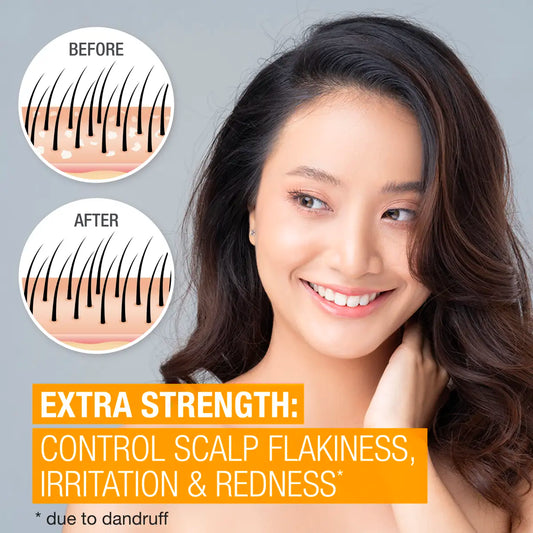 Neutrogena® Scalp Therapy Anti-dandruff Extra Strength - US 4484