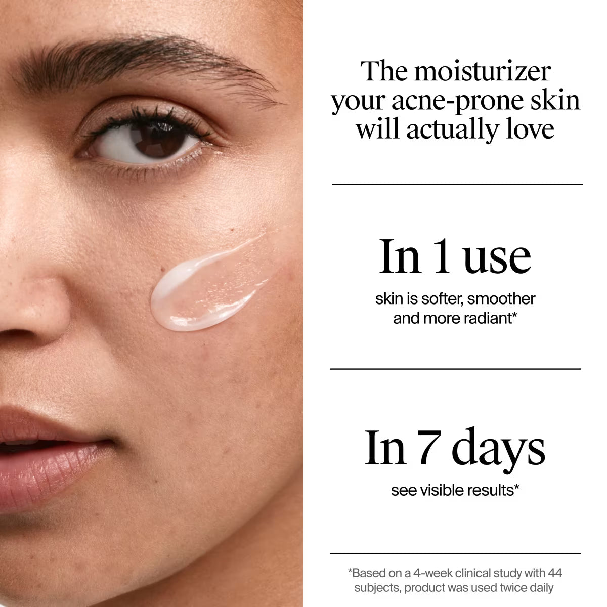 Neutrogena® Evenly Clear™ Acne Gel Moisturizer, 1.7oz - US 0712