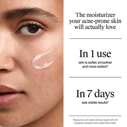 Neutrogena® Evenly Clear™ Acne Gel Moisturizer, 1.7oz - US 0712