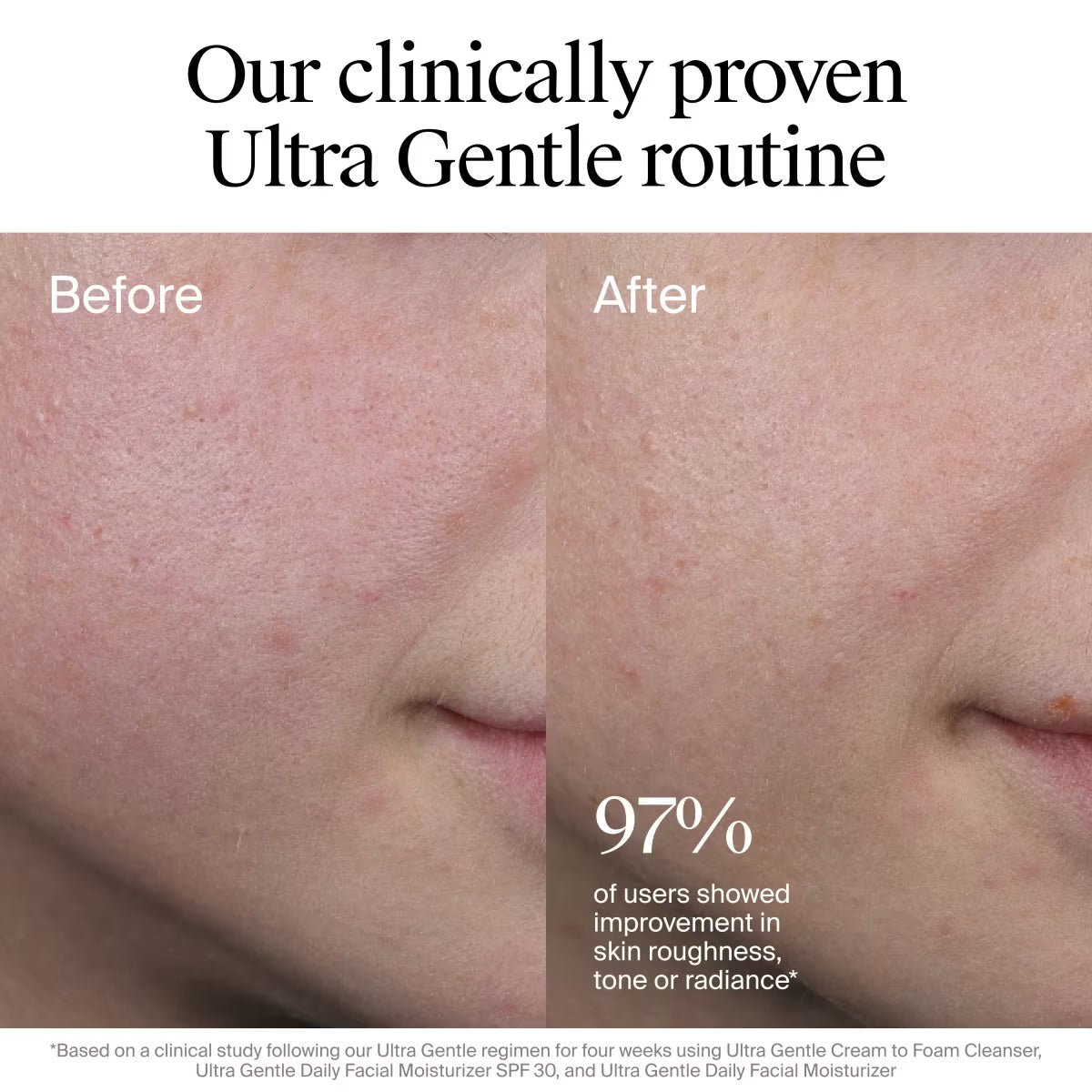 Neutrogena® Ultra Gentle Daily Facial Moisturizer with Broad Spectrum SPF 30, 3.4 Fl. Oz - US 3122