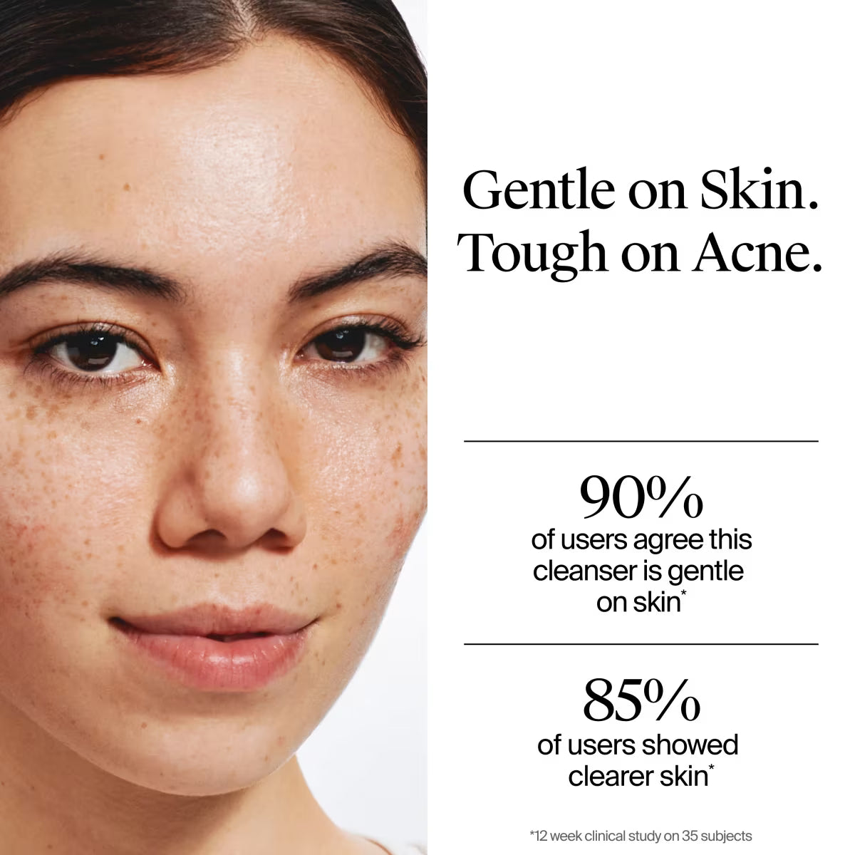 Neutrogena® Oil-Free Acne Wash, Fragrance Free 9.1 FL. Oz - US 6463